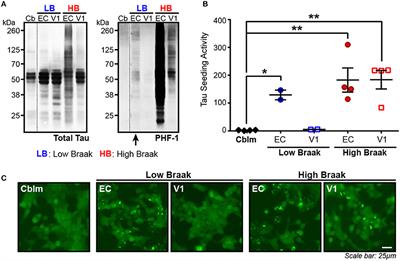 Synaptic Tau Seeding Precedes Tau Pathology in Human Alzheimer's Disease Brain